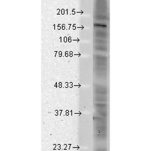 Western blot analysis of rat brain membrane lysate showing detection of SHANK protein using Anti-SHANK2 Antibody [N23b/49] (A304967) at 1:1,000 for 2 hours at room temperatur