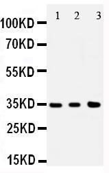 Anti-Caspase-7(P11) Rabbit Polyclonal Antibody