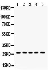 Anti-HSD17B10 Rabbit Polyclonal Antibody