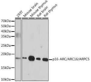 Anti-ARPC5/p16 ARC Rabbit Monoclonal Antibody [clone: ARC0221]