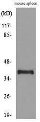 Anti-CD68 antibody