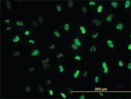 Anti-MEIS2 Mouse Monoclonal Antibody [clone: 1H4]