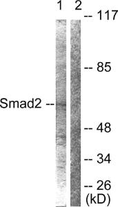 Anti-Smad2 + Smad3 Rabbit Polyclonal Antibody