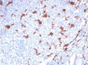 Immunohistochemical analysis of formalin-fixed, paraffin-embedded human tonsil tissue using Anti-L-PLUNC Antibody [LPLUNC1/7059R]. Inset: PBS instead of the primary antibody. Secondary antibody negative control