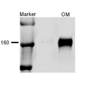 Western blot analysis of rat kidney tissue lysates showing detection of NKCC2 protein using Anti-NKCC2 Antibody (A304968) at 1:1,000