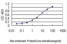 Anti-MEIS2 Mouse Monoclonal Antibody [clone: 1H4]