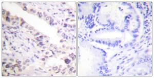 Anti-Smad2 + Smad3 Rabbit Polyclonal Antibody