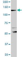 Anti-XPO5 Rabbit Polyclonal Antibody