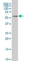 Anti-MEIS2 Mouse Monoclonal Antibody [clone: 1B3]