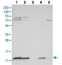 Anti-COA6 Rabbit Polyclonal Antibody