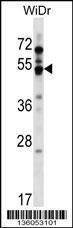 Anti-GPR84 Rabbit Polyclonal Antibody (APC (Allophycocyanin))