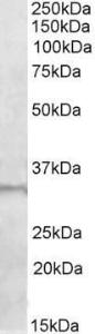 Anti-E2F6 Antibody (A84680) (1µg/ml) staining of Human Skeletal Muscle lysate (35µg protein in RIPA buffer). Primary incubation was 1 hour. Detected by chemiluminescence.