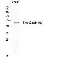 Anti-Smad2 + Smad3 Rabbit Polyclonal Antibody