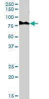 Anti-CHAT Goat Polyclonal Antibody