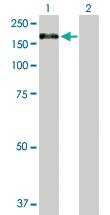 Anti-XPO5 Rabbit Polyclonal Antibody