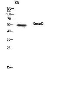 Anti-Smad2 + Smad3 Rabbit Polyclonal Antibody