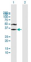 Anti-ACRV1 Mouse Polyclonal Antibody