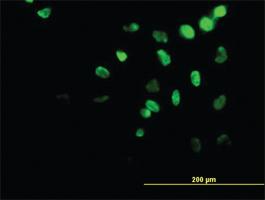 Anti-HOXA11 Mouse Monoclonal Antibody [clone: 5A3]