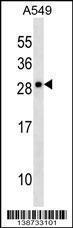 Anti-CLCF1 Rabbit Polyclonal Antibody