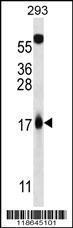 Anti-CDKN2A Rabbit Polyclonal Antibody (PE (Phycoerythrin))