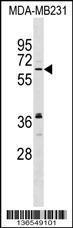 Anti-NSMF Rabbit Polyclonal Antibody (HRP (Horseradish Peroxidase))