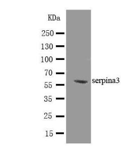 Anti-alpha 1 Antichymotrypsin Rabbit Antibody