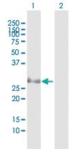 Anti-PSMB8 Rabbit Polyclonal Antibody