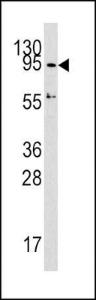 Anti-DNMT3A Rabbit Polyclonal Antibody (AP (Alkaline Phosphatase))