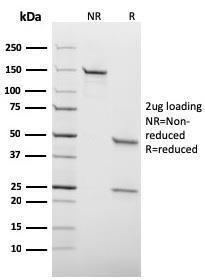 Anti-HSV1 antibody