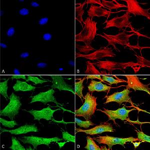 Immunocytochemistry/Immunofluorescence analysis of mouse NIH 3T3, fixed in 4% formaldehyde for 15  min at room temperature, using Anti-ATP7B Antibody [S62-29] (A304969), at 1:100 for 60  minutes at room temperature