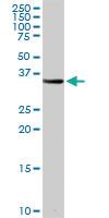 Anti-PSMB8 Rabbit Polyclonal Antibody