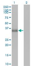 Anti-CGREF1 Mouse Monoclonal Antibody [clone: 2D7]