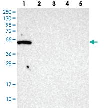 Anti-GTPBP10 Rabbit Polyclonal Antibody