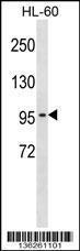 Anti-CLCN2 Rabbit Polyclonal Antibody (FITC (Fluorescein Isothiocyanate))