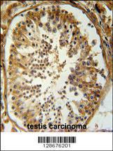 Anti-SRAC1 Rabbit Polyclonal Antibody (PE (Phycoerythrin))