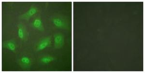 Immunofluorescence analysis of HeLa cells using Anti-JAB1 Antibody. The right hand panel represents a negative control, where the antibody was pre-incubated with the immunising peptide