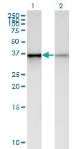 Anti-PHC2 Mouse Monoclonal Antibody [clone: 1F4]