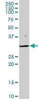 Anti-PSMB8 Rabbit Polyclonal Antibody