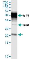 Anti-TMEM126B Rabbit Polyclonal Antibody