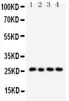 Anti-Surfactant Protein A Rabbit Polyclonal Antibody