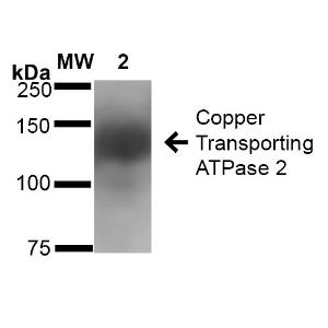 Western blot analysis of rat brain membrane showing detection of ~160 kDa Copper Transporting ATPase 2 protein using Anti-ATP7B Antibody [S62-29] (A304969) at 1:1000 for 16 hours at 4 °C. Lane 1: Molecular Weight Ladder (MW).