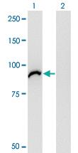 Anti-VAC14 Mouse Monoclonal Antibody [clone: 3B2]