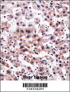 Anti-RCAN3 Rabbit Polyclonal Antibody (FITC (Fluorescein Isothiocyanate))