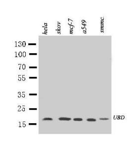 Anti-Diubiquitin Rabbit Antibody