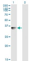 Anti-BLVRA Mouse Monoclonal Antibody [clone: S2]