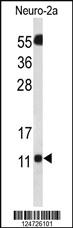 Anti-SZRD1 Rabbit Polyclonal Antibody