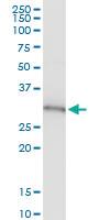 Anti-PSMB8 Rabbit Polyclonal Antibody