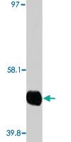 Anti-CYP2A6 Mouse Monoclonal Antibody [clone: F16 P2 D8]