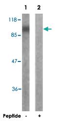 Anti-CBL Rabbit Polyclonal Antibody