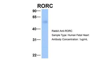 Anti-RORC Rabbit Polyclonal Antibody